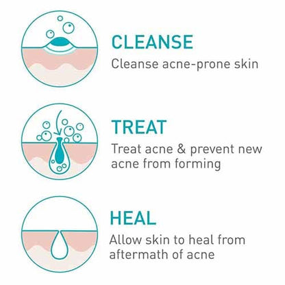 CeraVe Acne Foaming Cream Cleanser – 150ml